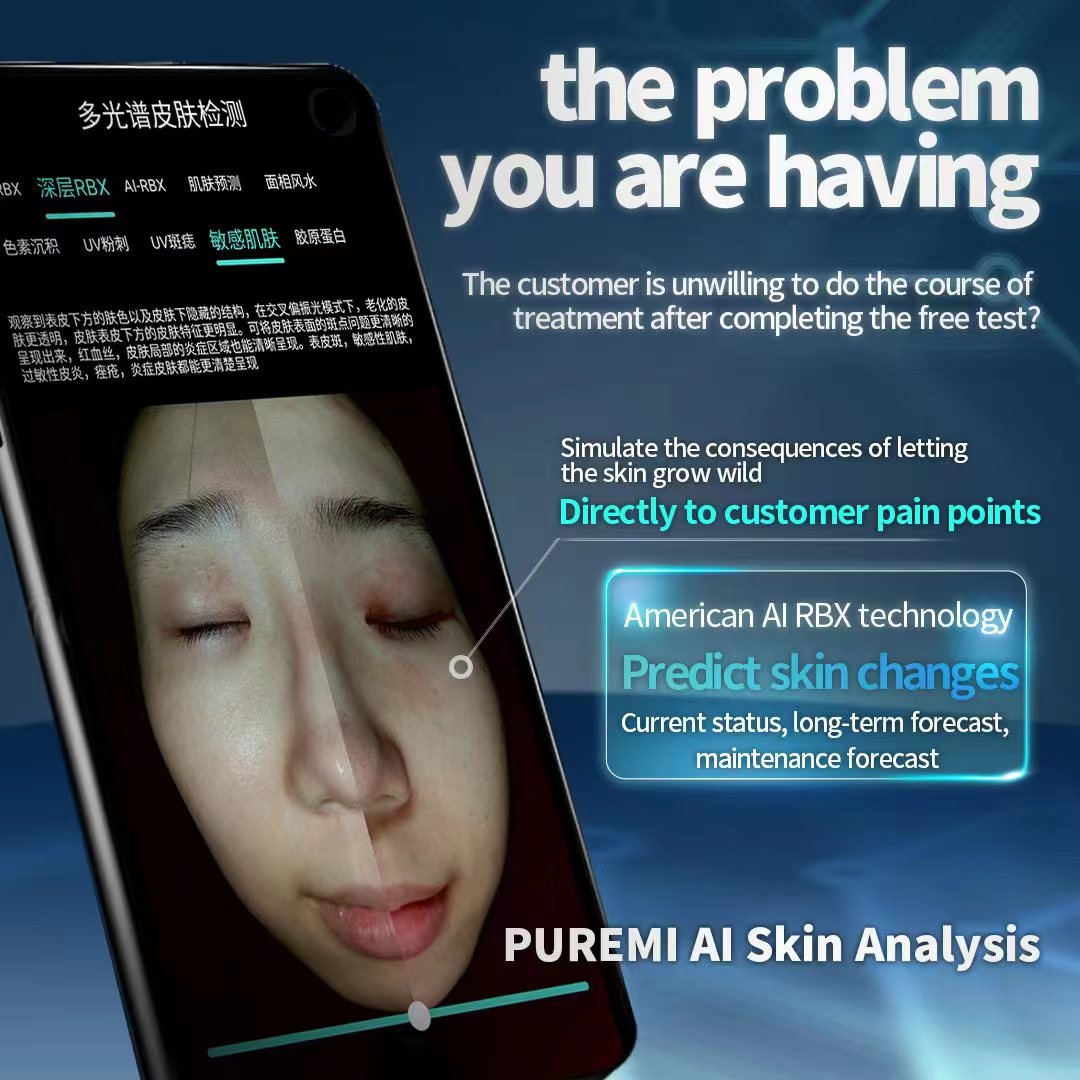 Meidazhao Skin Tester