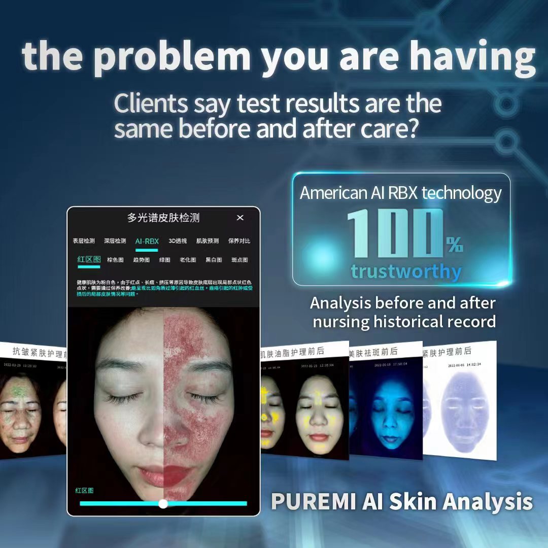 Meidazhao Skin Tester