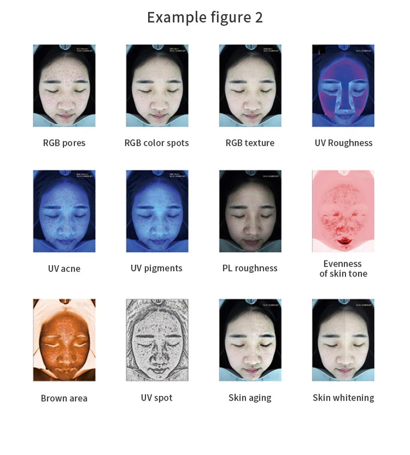 M9 Skin Tester Analyzer Skin Analysis Machine Facial Skin Analyzer for Vitam