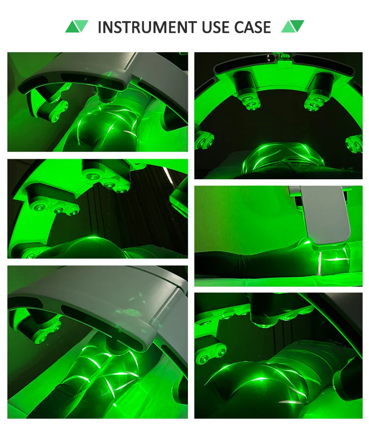 10D 532Nm Green Light Maxlipo Slim Body Shape System Lipolaser Master Laser Fat Loss Slimming Beauty Products for Weight Loss